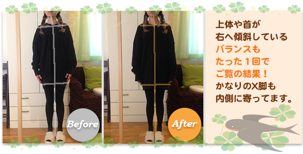 ビフォーアフター