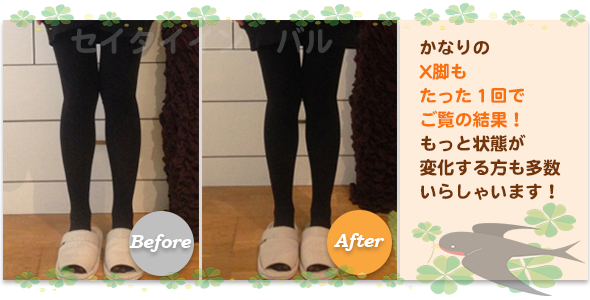 ビフォーアフター