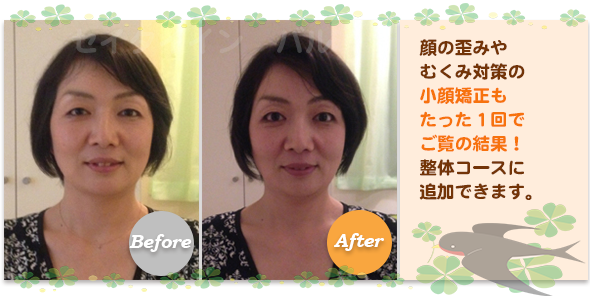 ビフォーアフター