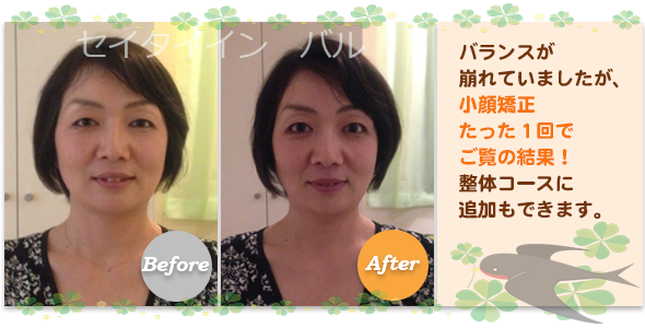 ビフォーアフター