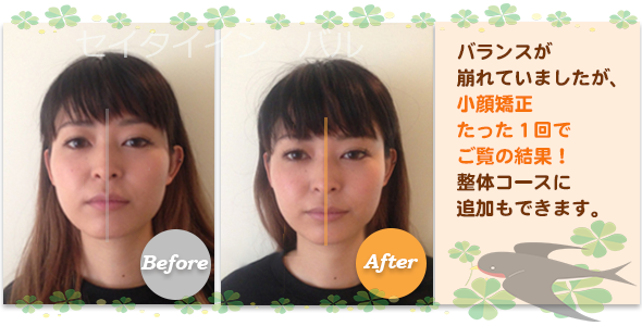 ビフォーアフター