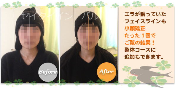 ビフォーアフター