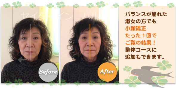 ビフォーアフター