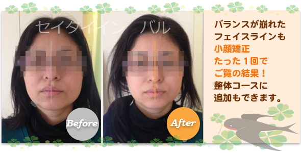 ビフォーアフター