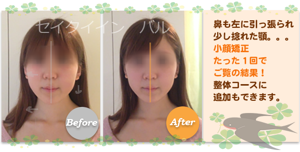 ビフォーアフター