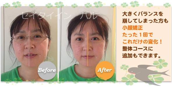 ビフォーアフター