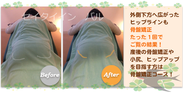 ビフォーアフター