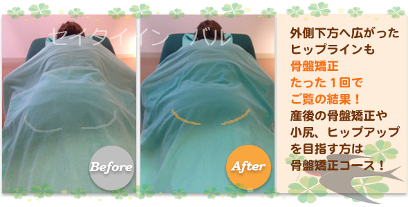 ビフォーアフター