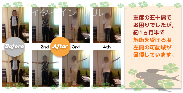 ビフォーアフター