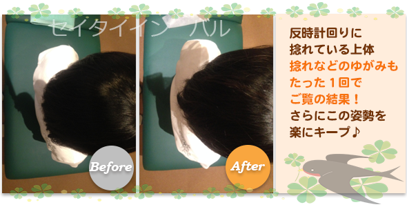 ビフォーアフター