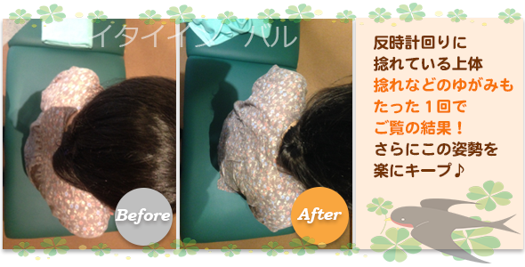 ビフォーアフター