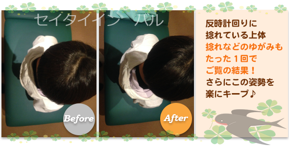 ビフォーアフター