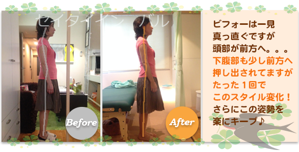 ビフォーアフター