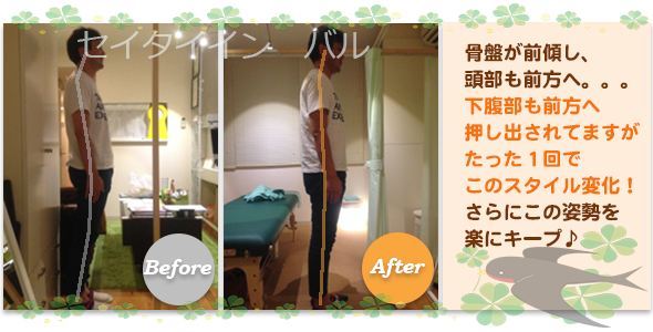 ビフォーアフター