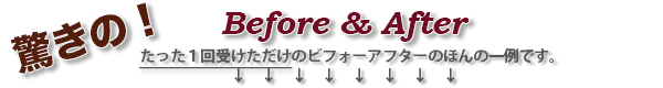 施術をたった１回受けただけのビフォーアフターのほんの一部です。